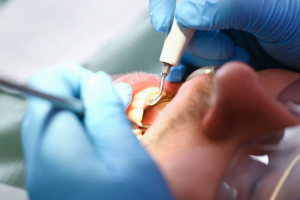Best Emergency Treatment for Toothache in Sandy Hook, CT