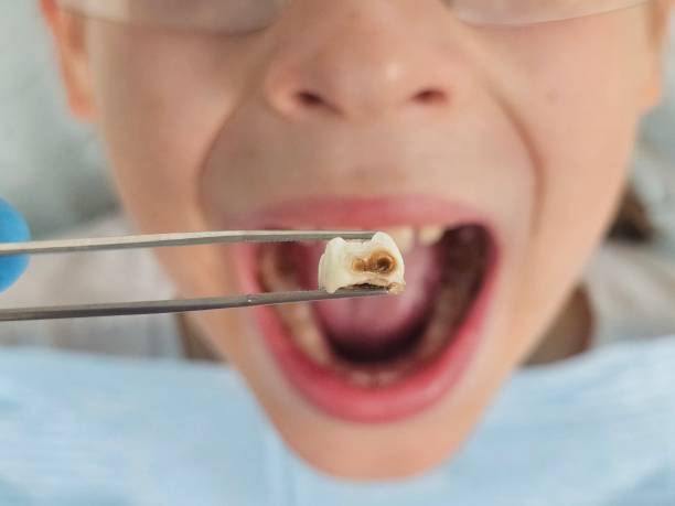 Best Pediatric Emergency Dentist in Sandy Hook, CT